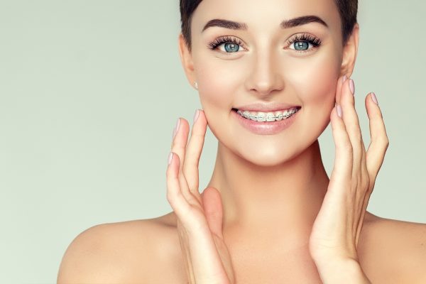 ¿Por qué verano es la época perfecta para comenzar tu Ortodoncia?